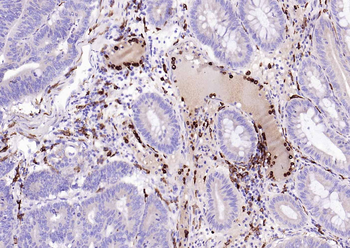 CD14 Recombinant Rabbit Monoclonal Antibody