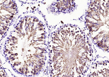 HSP70 Recombinant Rabbit Monoclonal Antibody