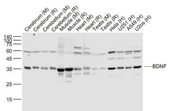 BDNF Recombinant Rabbit Monoclonal Antibody