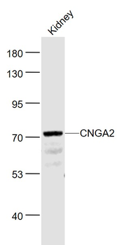 CNGA2 Rabbit Polyclonal Antibody