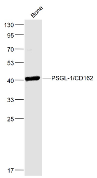 PSGL-1/CD162 Rabbit Polyclonal Antibody