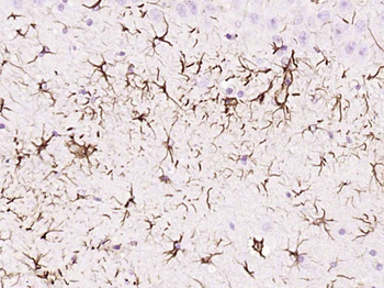 GFAP (ready to use) Mouse Monoclonal Antibody