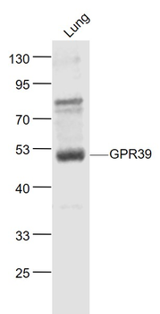 GPR39 Rabbit Polyclonal Antibody