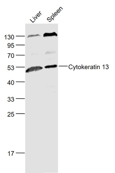 Cytokeratin 13 Rabbit Polyclonal Antibody