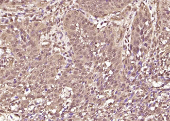 Phospho-STAT3 (Tyr705) Rabbit Polyclonal Antibody