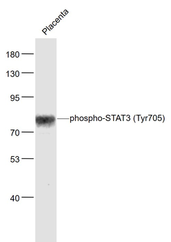 Phospho-STAT3 (Tyr705) Rabbit Polyclonal Antibody