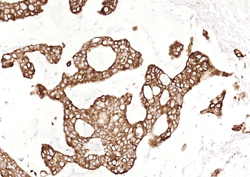 Cytokeratin 19 (ready to use) Mouse Monoclonal Antibody