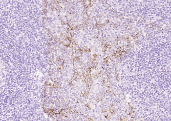 Cytokeratin 19 (ready to use) Mouse Monoclonal Antibody