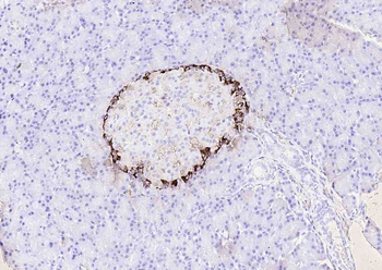 Glucagon Rabbit Polyclonal Antibody