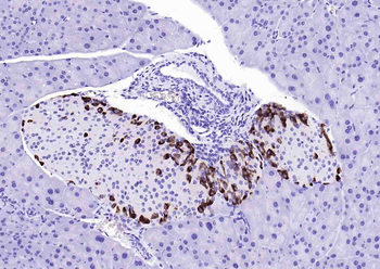 Glucagon Rabbit Polyclonal Antibody