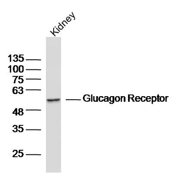 Glucagon Receptor Rabbit Polyclonal Antibody