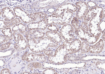 G6PC Rabbit Polyclonal Antibody