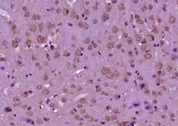 GRB10 Rabbit Polyclonal Antibody