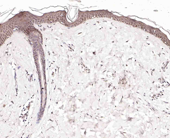 NOXA2 Rabbit Polyclonal Antibody