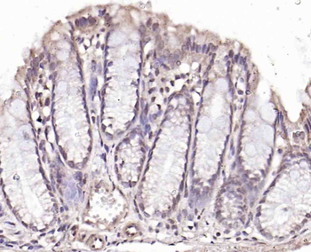 NOXA2 Rabbit Polyclonal Antibody