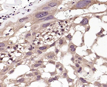 NOXA2 Rabbit Polyclonal Antibody