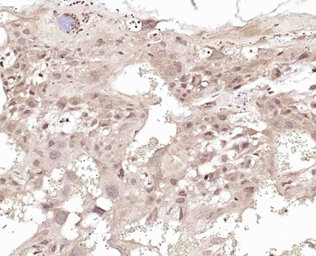 NOXA2 Rabbit Polyclonal Antibody