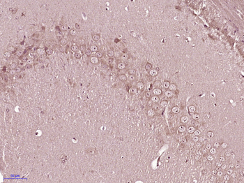 Glycogen synthase 1 Rabbit Polyclonal Antibody