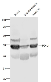 PD-L1 Rabbit Polyclonal Antibody