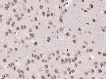 UBF1 Rabbit Polyclonal Antibody