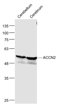 ACCN2 Rabbit Polyclonal Antibody