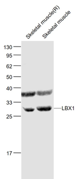 LBX1 Rabbit Polyclonal Antibody