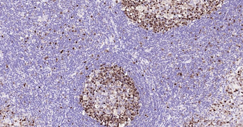 PCNA Recombinant Rabbit Monoclonal Antibody (Nuclear Loading Control)