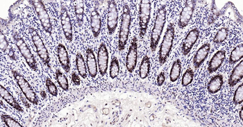 PCNA Recombinant Rabbit Monoclonal Antibody (Nuclear Loading Control)