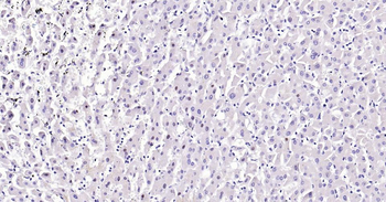 PCNA Recombinant Rabbit Monoclonal Antibody (Nuclear Loading Control)