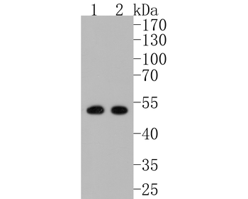 PICK1 Recombinant Rabbit Monoclonal Antibody