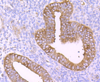 TNFR2 Recombinant Rabbit Monoclonal Antibody