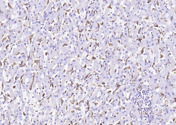 CD163 Recombinant Rabbit Monoclonal Antibody