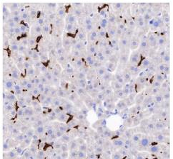 CD163 Recombinant Rabbit Monoclonal Antibody