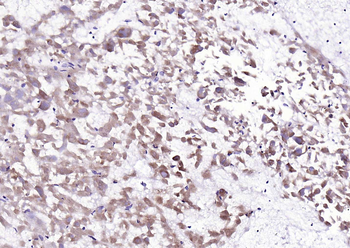 Galectin 8 Recombinant Rabbit Monoclonal Antibody