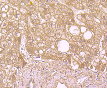 SOD2 Recombinant Rabbit Monoclonal Antibody