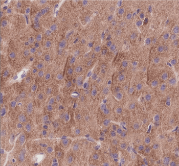 Trk A + B + C Recombinant Rabbit Monoclonal Antibody
