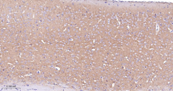 Trk A + B + C Recombinant Rabbit Monoclonal Antibody