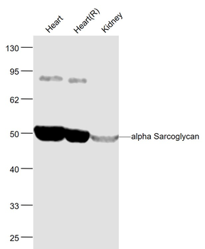 Alpha Sarcoglycan Rabbit Polyclonal Antibody