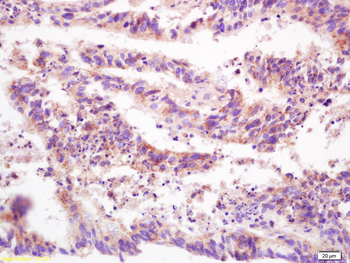 DEP1 Rabbit Polyclonal Antibody