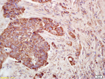 DEP1 Rabbit Polyclonal Antibody