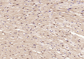TNMD Rabbit Polyclonal Antibody