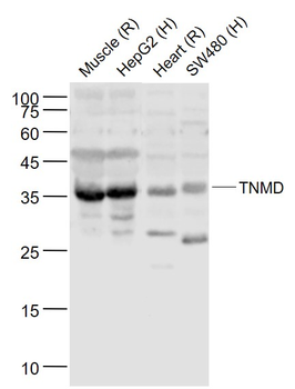 TNMD Rabbit Polyclonal Antibody
