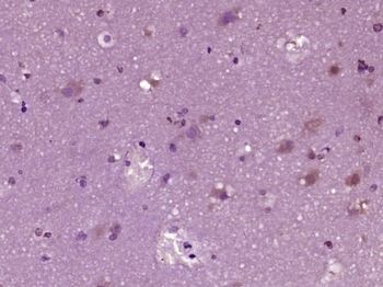 HDAC5 Rabbit Polyclonal Antibody