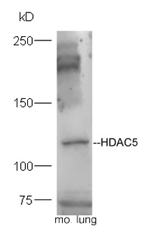 HDAC5 Rabbit Polyclonal Antibody