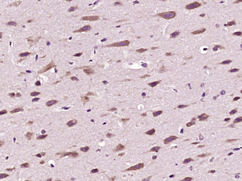 HDAC10 Rabbit Polyclonal Antibody