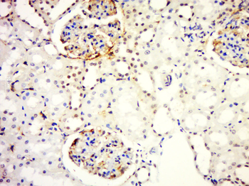 Phospho-HER2 (Tyr1248) Rabbit Polyclonal Antibody