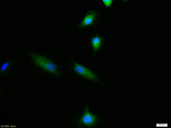 Phospho-HER2 (Tyr877) Rabbit Polyclonal Antibody