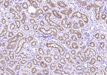 LRP2 Rabbit Polyclonal Antibody