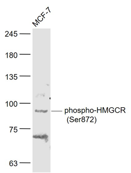 Phospho-HMGCR (Ser872) Rabbit Polyclonal Antibody