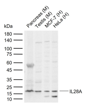 IL28A Rabbit Polyclonal Antibody